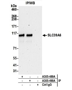Bethyl Laboratories, a Fortis LS Co. Rabbit Anti-Slc39a6 Antibody, Affinity Purified, Host: Rabbit, Conjugate Type: Unconjugated, 10 µl (1000 µg/ml)