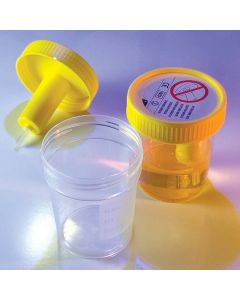 Globe Scientific Transfertop Urine Colle