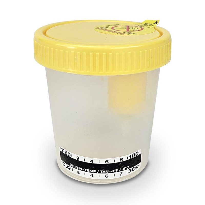 Globe Scientific Transfertop Urine Colle