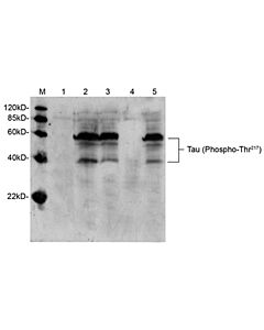 Genscript Tau Antibody (Phospho-Thr217), pAb, Rabbit