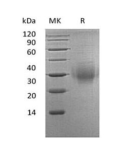 Genscript BTLA/CD272, His, Human