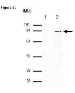 Millipore Ripab+ Suz12 - Rip Validated Antibody And Primer Set