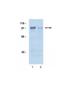 Millipore Anti-Phospho-Androgen Receptor (Ser81) Antibody, Rabbit