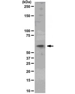 Millipore Anti-Akt2/Pkbbeta Antibody, Clone Aw114, Rabbit Monoclonal