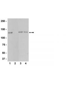 Millipore Anti-Phospho-Enos/Nos Iii (Thr495) Antibody, Rabbit Monoclonal