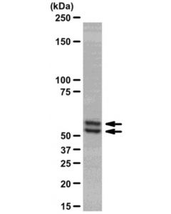 Millipore Anti-Smad2/3 Antibody, Clone C4t, Rabbit Monoclonal