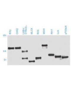 Millipore Anti-Phosphoserine Antibody, Clone 4a4 (Mouse Igg1)
