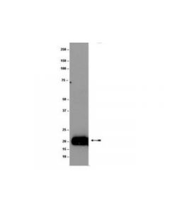 Millipore Anti-Ras Antibody, (K-, H-, N-), Clone 9a11.2