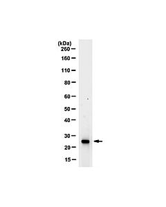 Millipore Anti-Ubiquityl-Histone H2b Antibody, Clone 56