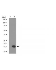 Millipore Anti-Phospho-Histone H3 (Ser10) Antibody, Clone Cma312