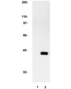Millipore Anti-Map Kinase 2/Erk2 Antibody, Clone 1b3b9