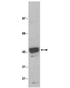 Millipore Anti-Na+/K+ Atpase Beta-1 Antibody, Clone C464.8