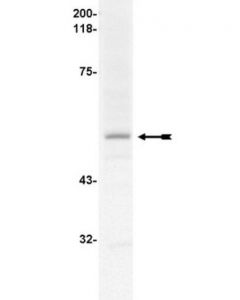 Millipore Anti-Fcepsilonri Alpha Subunit Antibody