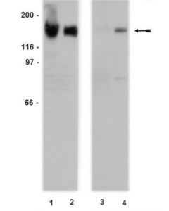 Millipore Anti-Egfr (Non-Phospho-Tyr1173) Antibody, Clone 20g3