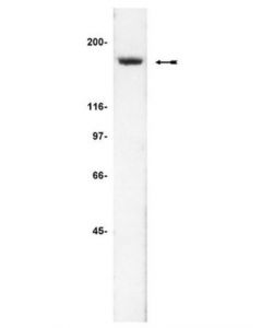 Millipore Anti-Iqgap2 Antibody, Clone Bb9