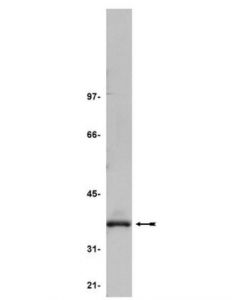 Millipore Anti-Pp2a Antibody, C Subunit, Clone 7a6