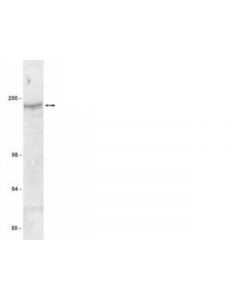 Millipore Anti-Cftr Antibody, Clone Mm13-4