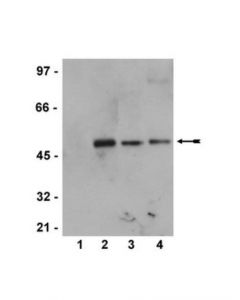 Millipore Anti-Phospho-Mek1 (Ser218/222)/Mek2 (Ser222/226) Antibody,