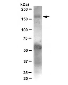 Millipore Anti-Irs1 Antibody, Clone 58-10c-31, Rabbit Monoclonal