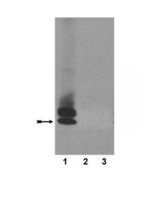 Millipore Anti-Amyloid Beta (Abeta)X-40 Antibody, Clone 11a5-B10