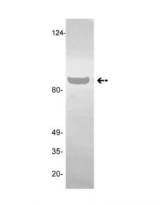 Millipore Anti-Plasminogen/Angiostatin Antibody, Clone Gma-013