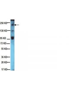 Millipore Anti-Erbb-2/Her-2 Antibody