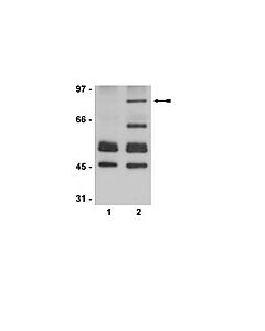 Millipore Anti-Acetyl-P53 Antibody (Lys373, Lys382)