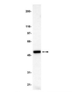 Millipore Anti-P47-Phox Antibody