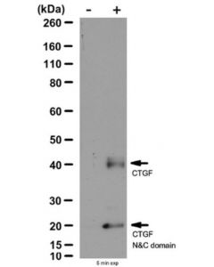 Millipore Anti-Connective Tissue Growth Factor Antibody