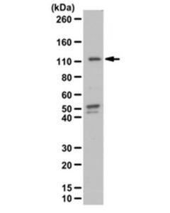 Millipore Anti-Phospho-Stat2 (Tyr689) Antibody