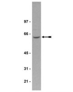 Millipore Anti-Pp2a Antibody, A Subunit