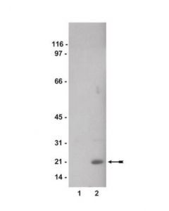 Millipore Anti-Phospho-Cofilin 2 (Ser3) Antibody