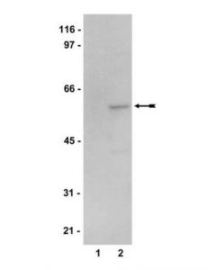 Millipore Anti-Ampk Alpha2 Antibody