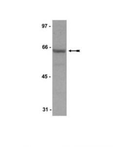 Millipore Anti-Shp-1/Shptp-1 Antibody