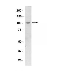 Millipore Anti-Pkd2 Antibody