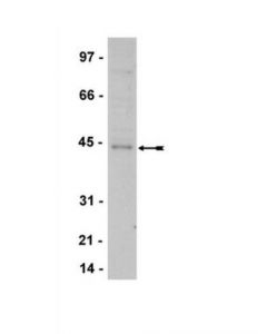 Millipore Anti-Ttf-1 Antibody