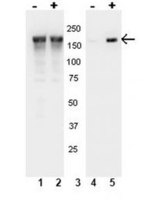 Millipore Anti-Phospho-Egfr (Tyr1148) Antibody