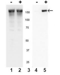 Millipore Anti-Phospho-Egfr (Tyr845) Antibody