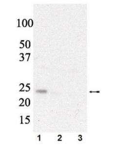 Millipore Anti-Phospho Eif4e (Ser209) Antibody