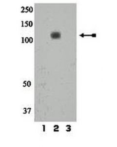 Millipore Anti-Phospho-Ir/Igf1r (Tyr1158) Antibody