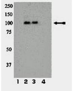 Millipore Anti-Phospho-Ir/Igf1r (Tyr1158/Tyr1162/Tyr1163) Antibody
