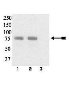 Millipore Anti-Phospho-Limk 1/2 (Tyr507/Thr508) Antibody