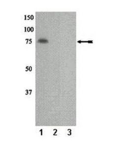 Millipore Anti-Phospho-Pkceta (Thr655) Antibody