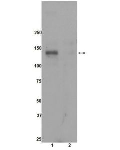 Millipore Anti-Phospho-Ack1 (Tyr284) Antibody