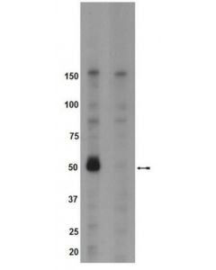 Millipore Anti-Phospho-Brk (Tyr342) Antibody