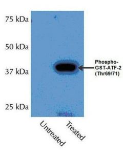 Millipore Anti-Phospho-P38alpha (Thr180/Tyr182) Antibody