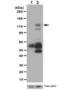 Millipore Anti-Phospho-Jak2 (Tyr1007/1008) Antibody