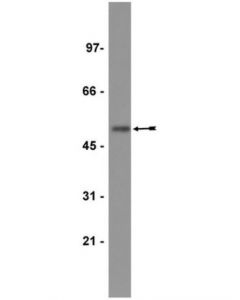 Millipore Anti-Histidine Tagged Antibody, Clone 4d11, Biotin Conjugate
