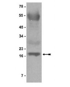 Millipore Protein G Agarose/Salmon Sperm Dna, 2.5 Ml
