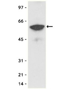 Millipore Anti-Myc Tag Antibody, Clone 4a6, Agarose Conjugate